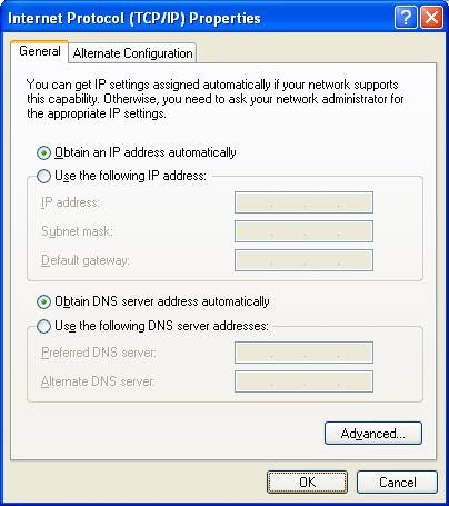 Choose "obtain an IP address automatically".